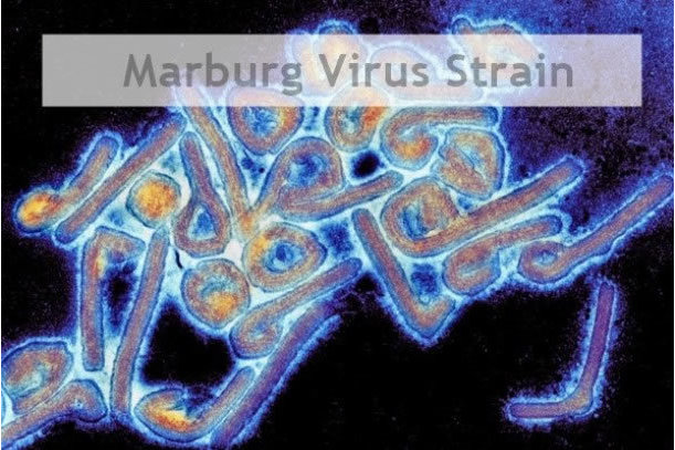 US agency discovers deadly Marburg virus in Sierra Leone